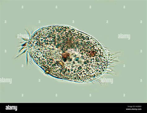  Heterotrichous Ciliate: A Microscopic Mastermind Embracing Both Peaceful Filter Feeding and Opportunistic Predatory Behavior!