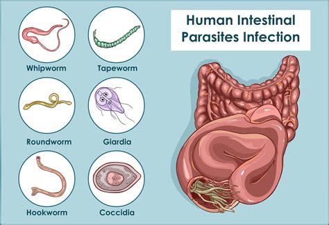  Ribothrea: Can This Tiny Parasite Conquer Your Digestive System?